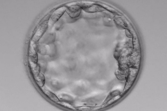 凍結更新について